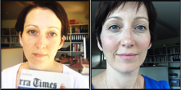 before-and-after