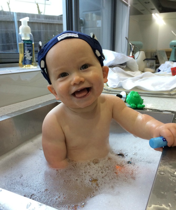 Oliver at 10 months wearing his hearing henry