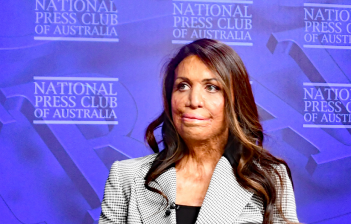 Turia Pitt: How to rewrite your own story